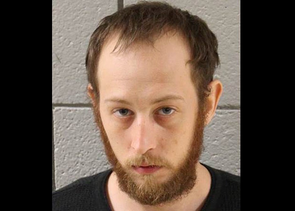 Pa. man accused of illegally owning human brain, using embalming fluid to get high