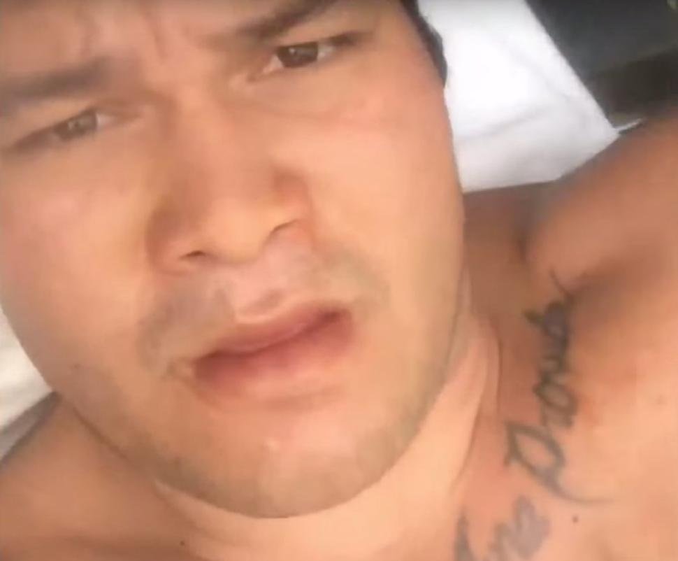Hawaii fisherman bit on leg by shark recalls fight for life: 'I punched her in the nose'