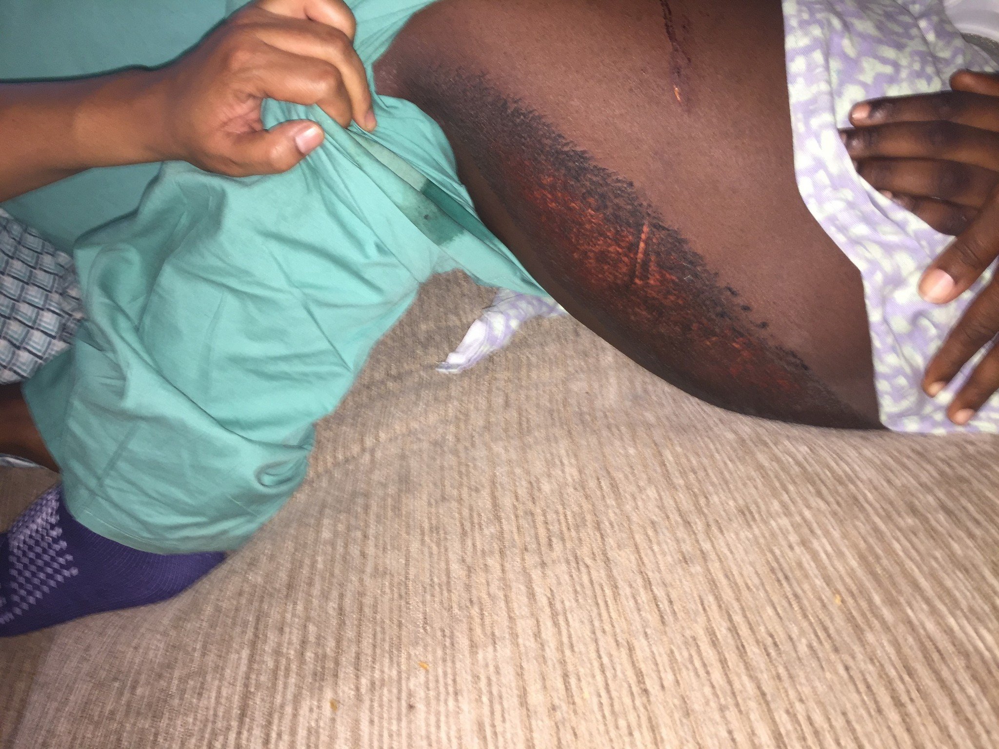 Family of 15-year-old Syracuse girl injured in Near West Side shooting wants answers