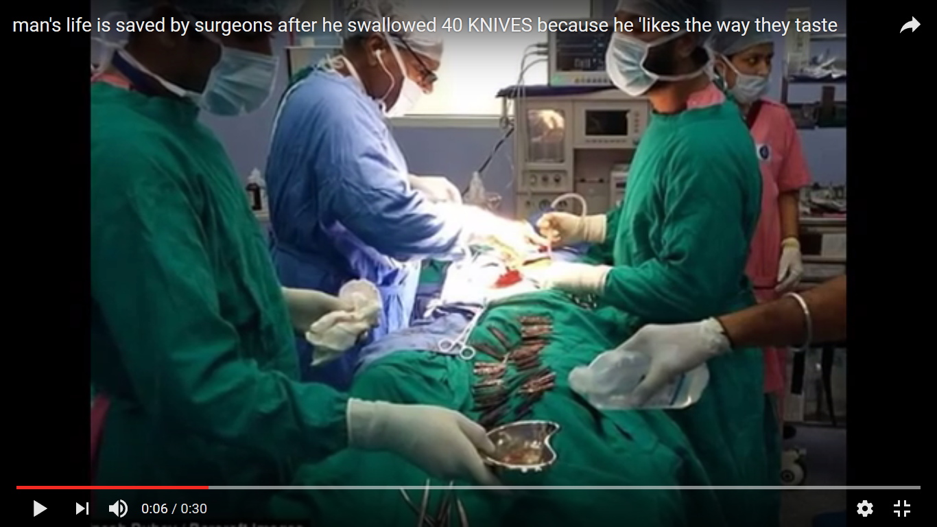 Surgeons remove 40 knives from man's stomach
