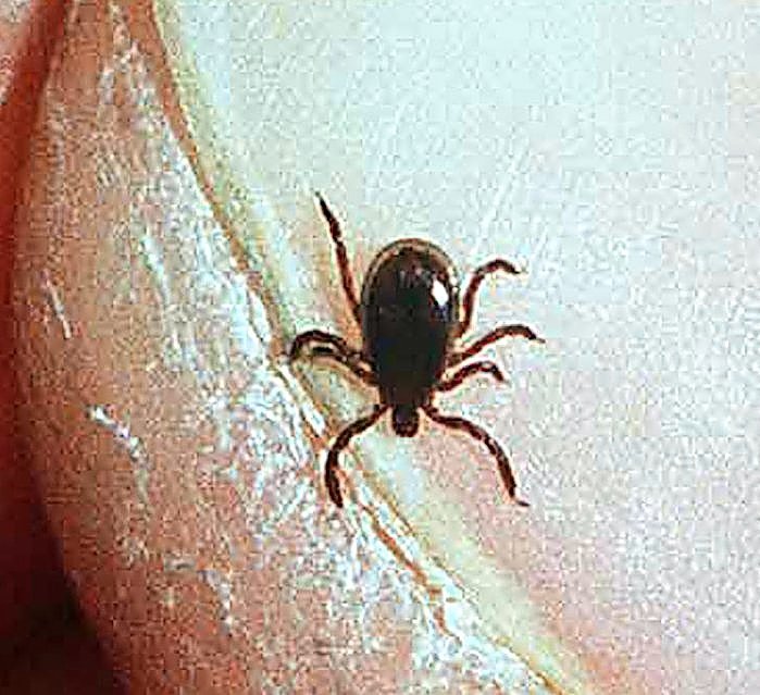 Which New York counties have highest rates of Lyme disease? (chart)